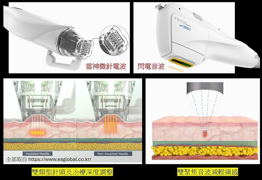 微針電波 、 音波拉提 與 Focus Dual 是什麼?效果、技術以及適合對象一次了解 - 第3張圖