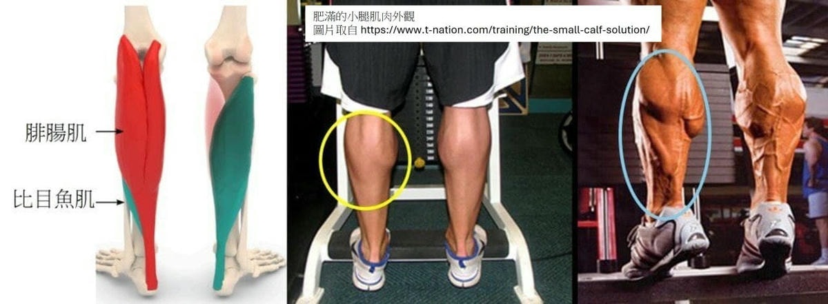 超音波瘦小腿 精準注射打造曲線美腿，腓腸肌與比目魚肌的塑型關鍵，更準確也更安全