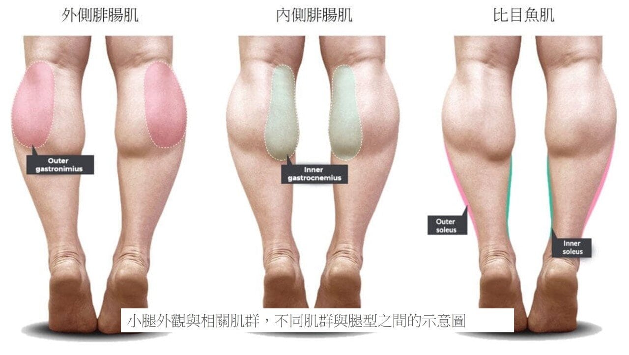 超音波瘦小腿 精準注射打造曲線美腿，腓腸肌與比目魚肌的塑型關鍵，更準確也更安全